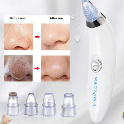 ⭐ Pore Cleaning Device – Deep Clean for Smooth & Clear Skin