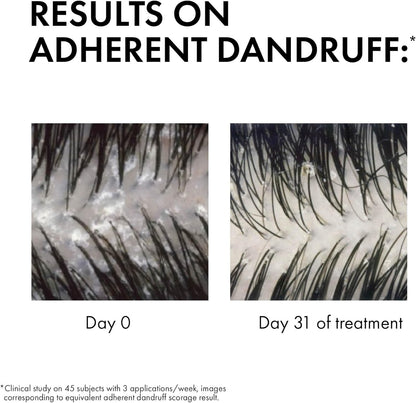 Vichy Dercos Anti-Dandruff Treatment Shampoo 🌿 200ml