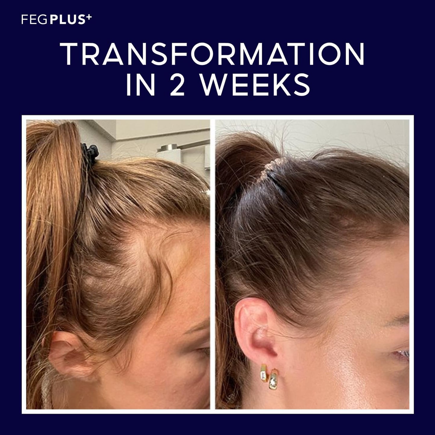 FEG® Advanced Hair Growth Spray – Revitalize Roots & Boost Thickness